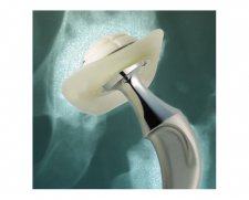 Depuy Synthes Elite Plus Ogee Acetabulum | Used in Primary hip replacement, Revision hip replacement  | Which Medical Device